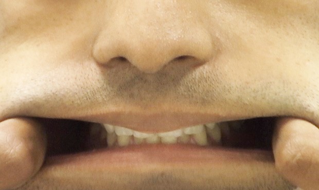 This mouth is from Brenden Fernandes’ video, Foe (2008), and will be on view for Speculations. Risquer l’Interprétation