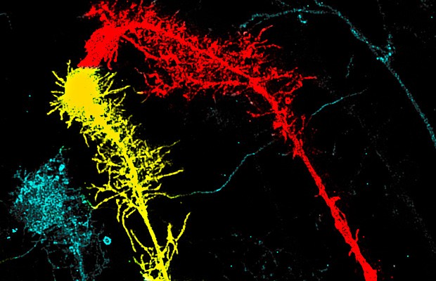 “Kissing” radial glia cells in the optic tectum (brain) of living intact Xenopus laevis tadpole, captured with two-photon microscopy. | Photo by Mari Sild and Edward Ruthazer “Kissing” radial glia cells in the optic tectum (brain) of living intact Xenopus laevis tadpole, captured with two-photon microscopy. | Photo by Mari Sild and Edward Ruthazer