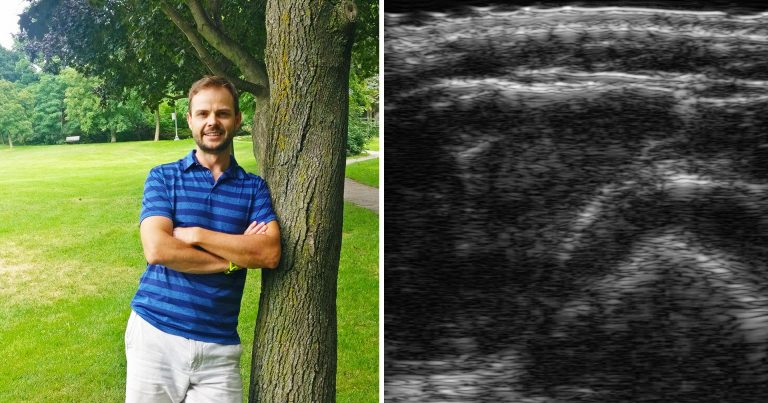 At left: Jesse Whyte. At right: An ultrasound image of an arm that depicts a cross-sectional slice, which Whyte uses to measure skin, body fat and muscle thickness.
