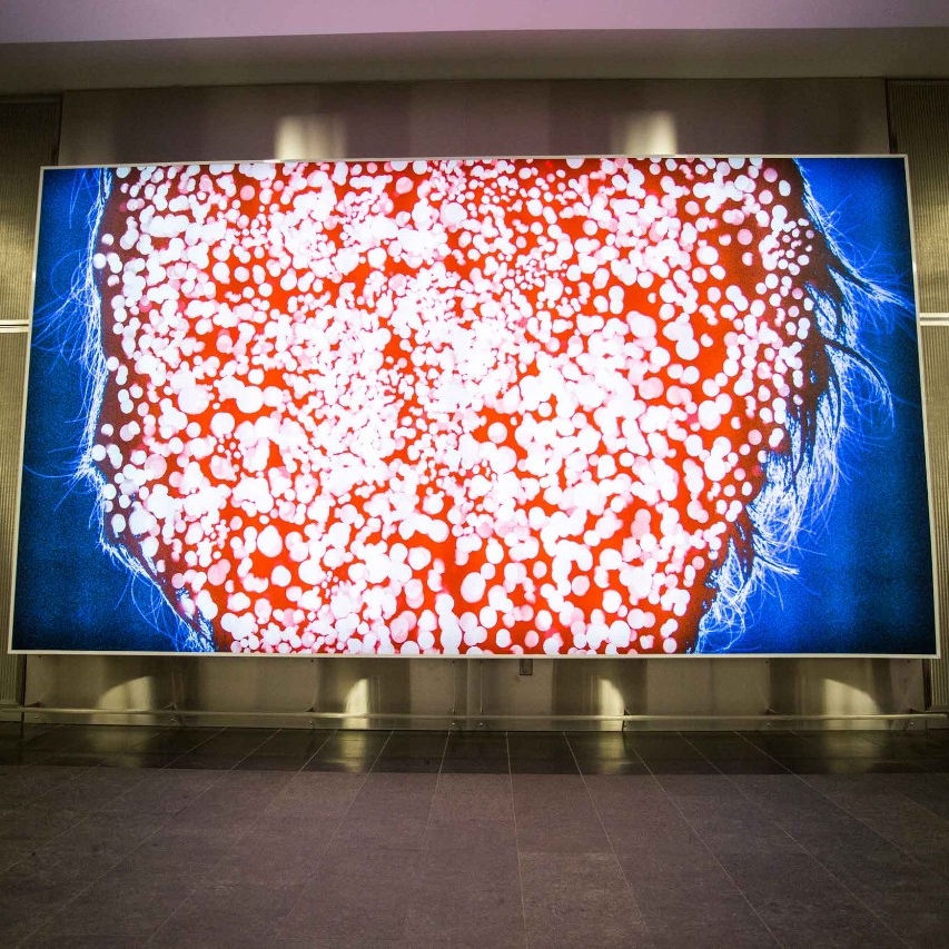 The shape of a human head coloured in red and populated with hundreds of white spots. Illuminated from behind the head shape, wisps of hair glow against a dark blue background