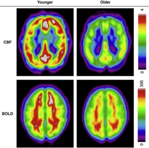 Cerebral bloodflow (CBF) and blood oxygen level-dependent (BOLD) measurements. Figure taken from Gauthier et al. Age dependence of hemodynamic response characteristics in human functional magnetic resonance imaging. Neurobiology of Aging, 34(5), 1469–1485.