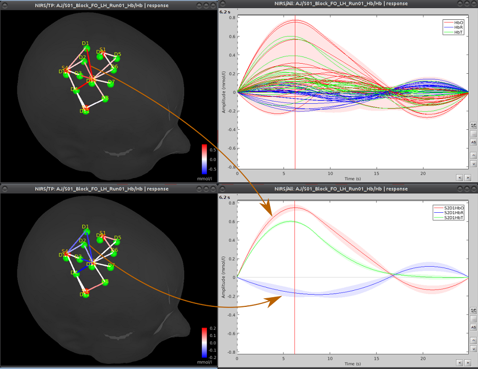Analysis of functional Near-InfraRed Spectroscopy (fNIRS) data acquired during a motor experiment Analysis of functional Near-InfraRed Spectroscopy (fNIRS) data acquired during a motor experiment