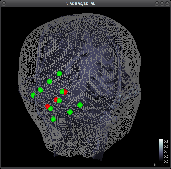 Multimodal view of a NIRS occipital montage Multimodal view of a NIRS occipital montage