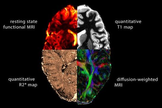 colourized image of brain divided into four quadrants showing different types of test results