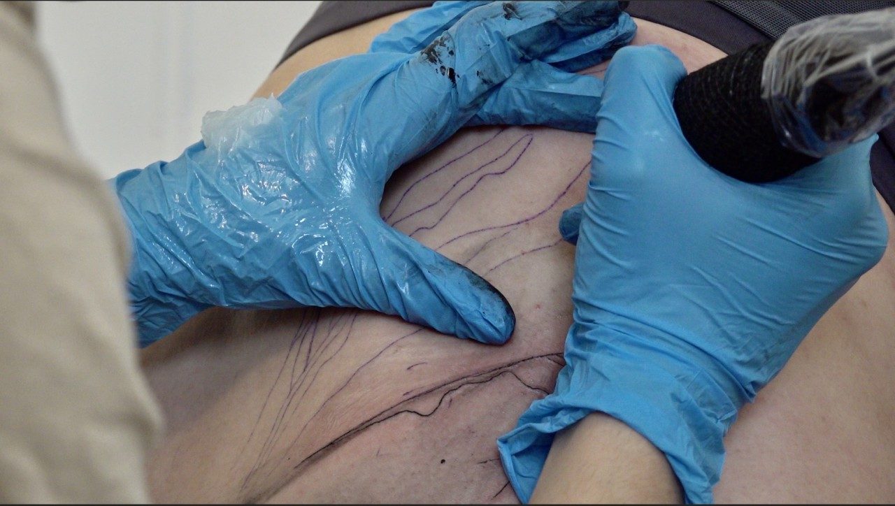 Digital photograph of a tattoo session, we see two hands wearing blue gloves with a tattoo gun tracing abstract lines on someone's lower backside. 