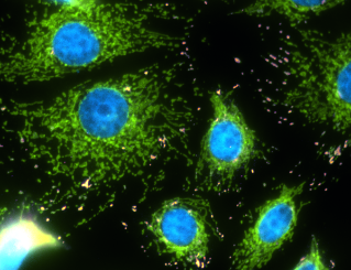 Breast Cancer Cell Mitochondrial networks