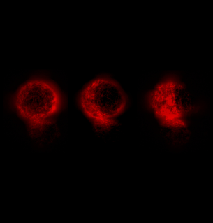 C Elegans embryo dividing (100x)