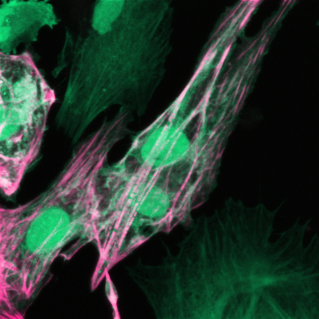Cardiomyocyte imaged at 60x