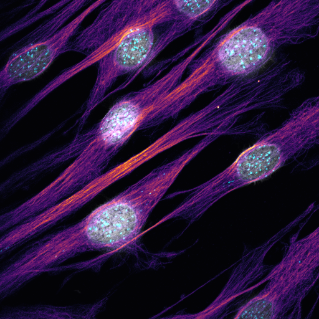 Human Fibroblasts