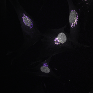 Golgi apparatus in human fibroblasts (60x)