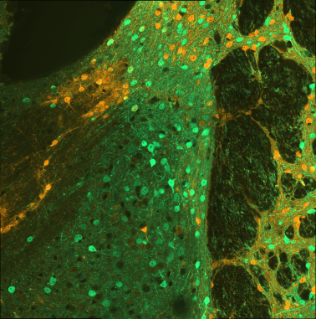 Rat striatal neurons (10x)