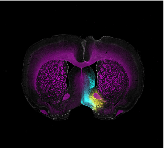 Dopaminergic neurons in the rat brain