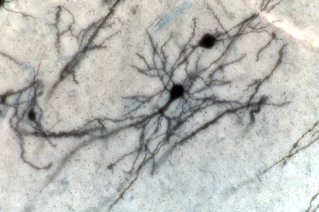 Golgi-labelled Hippocampal rat neurons