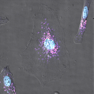 HeLa cells treated with nanoparticles