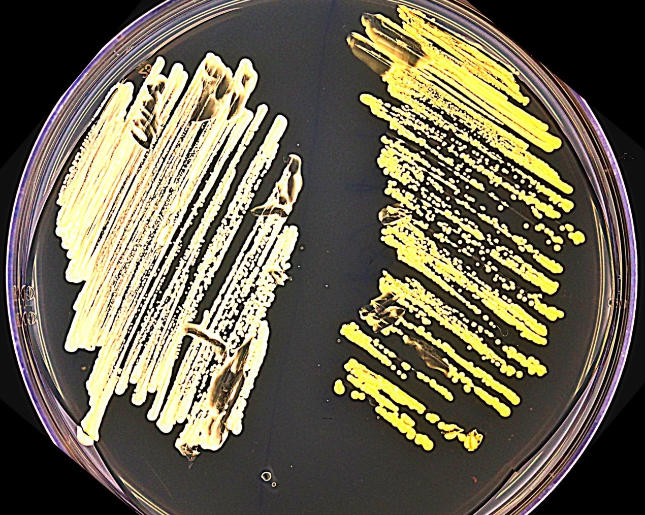 Yellow yeast cells