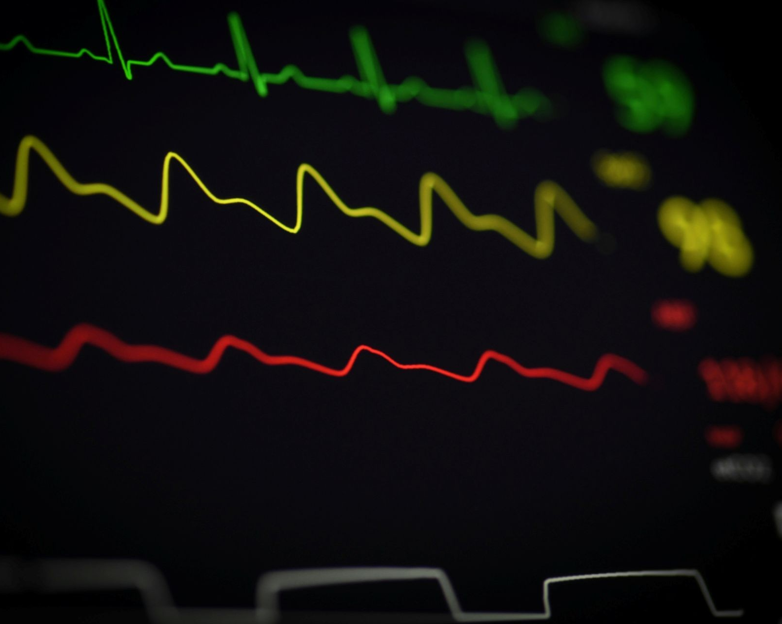RESEARCH: A new AI tool developed at Concordia enhances CPR monitoring