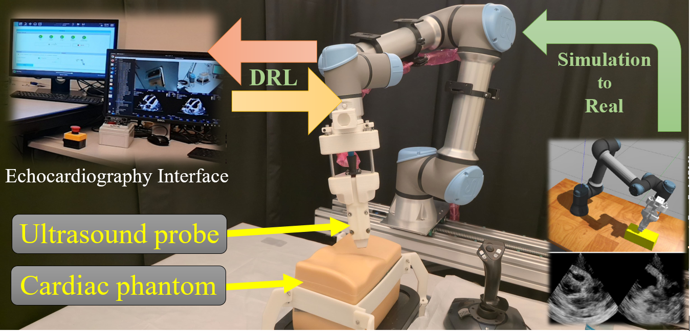 Autonomous ECG model