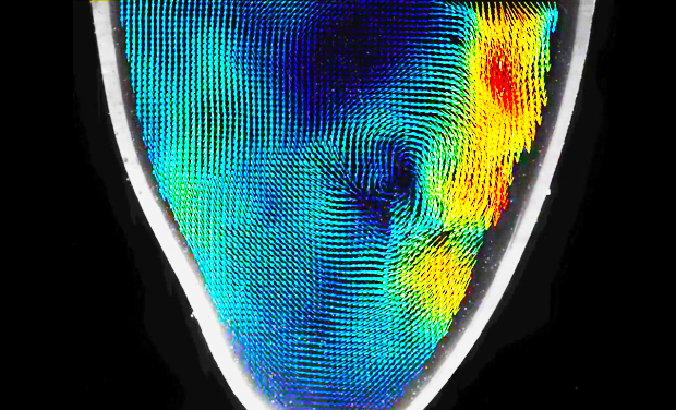 Concordia research examines the blood flow of real patients using 3D-printed models of their heart valves. Concordia research examines the blood flow of real patients using 3D-printed models of their heart valves.