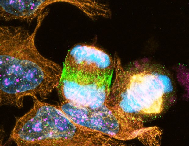 Two dividing cells in different phases of mitosis surrounded by interphase cells. | Courtesy of The Centre for Microscopy and Cellular Imaging (CMCI)