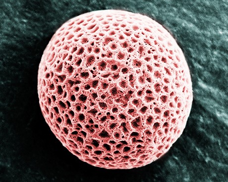 This Concordian could win a $2,000 science photo prize