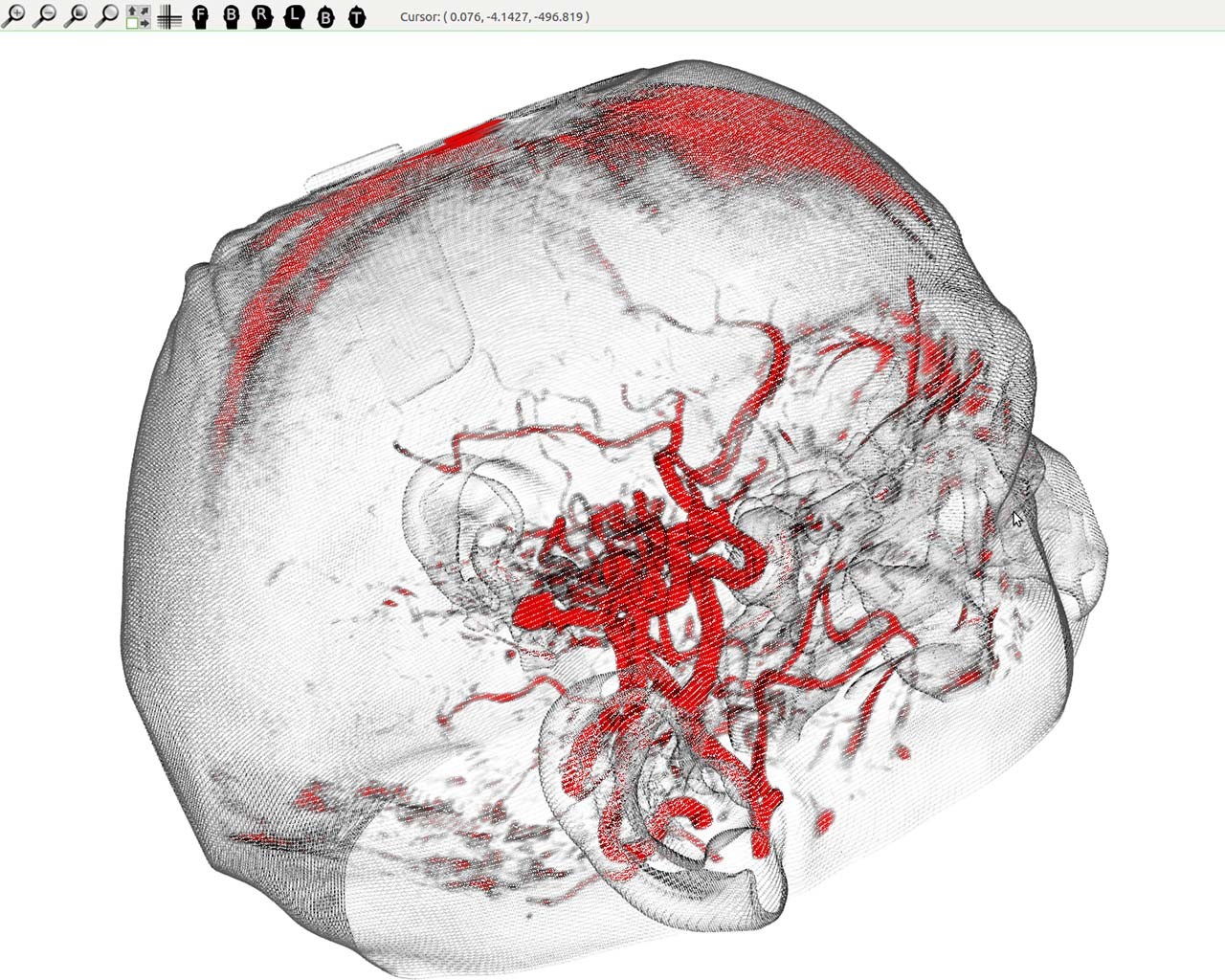 Three-dimensional images projected onto a skull