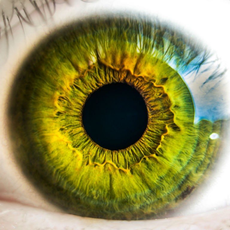 Monitoring glaucoma, the 'silent thief of sight'