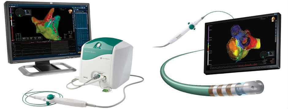 TactiCath™ Ablation Catheter, Sensor Enabled™, Abbot Medical Inc. | Courtesy of Abbot Medical Inc. TactiCath™ Ablation Catheter, Sensor Enabled™, Abbot Medical Inc. | Courtesy of Abbot Medical Inc.