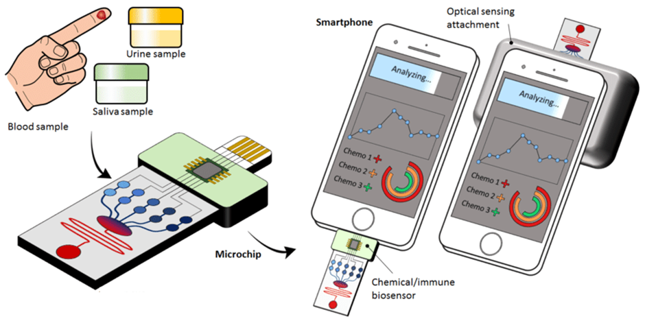 Microfluidic devices integrated by biosensors and smartphone to load blood, urine or saliva samples for the detection of pancreatic cancer patients at Point-Of-Care (Samandari et al., 2018)