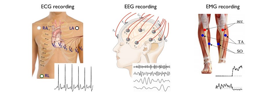 Leads placement of ECG (left, Leutheuser 2019), EEG (middle, Kandel et al. 2012) and EMG (right, Tao et al. 2015, Lith et al. 2018) and their recordings 