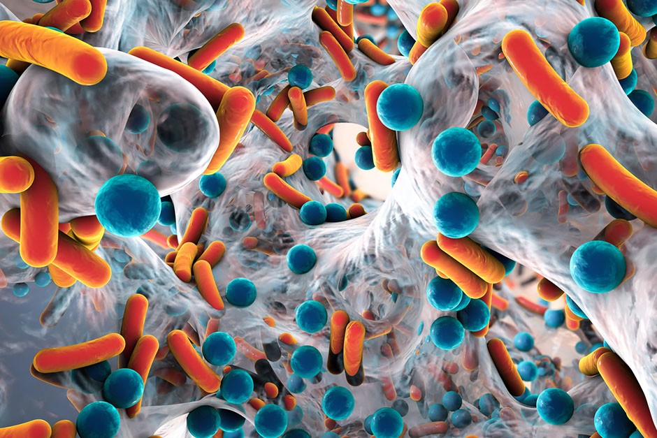 Different shapes and sizes of antibiotic-resistant bacteria float inside a biofilm.