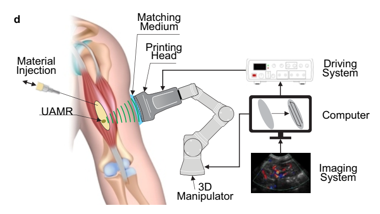 Direct sound printing image: medical use