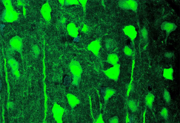 Concordia researchers used optogenetics to selectively activate neurons that expressed a light-activated protein channel, shown here in fluorescent green. | Photo by Franz Villaruel