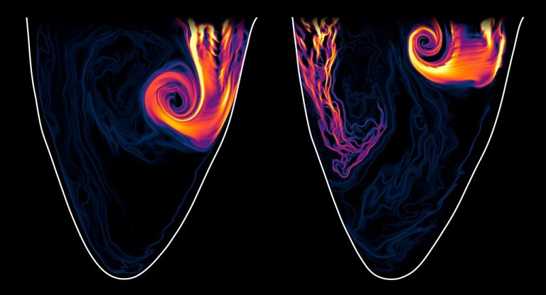 “Laminar healthy vortices and leaking heart valves” by Giuseppe Di Labbio