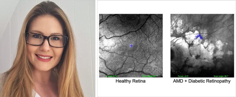 Left: Woman with long, blonde hair and glasses. Right: A close-up of a healthy retina, and a close-up of a retina destroyed by disease.