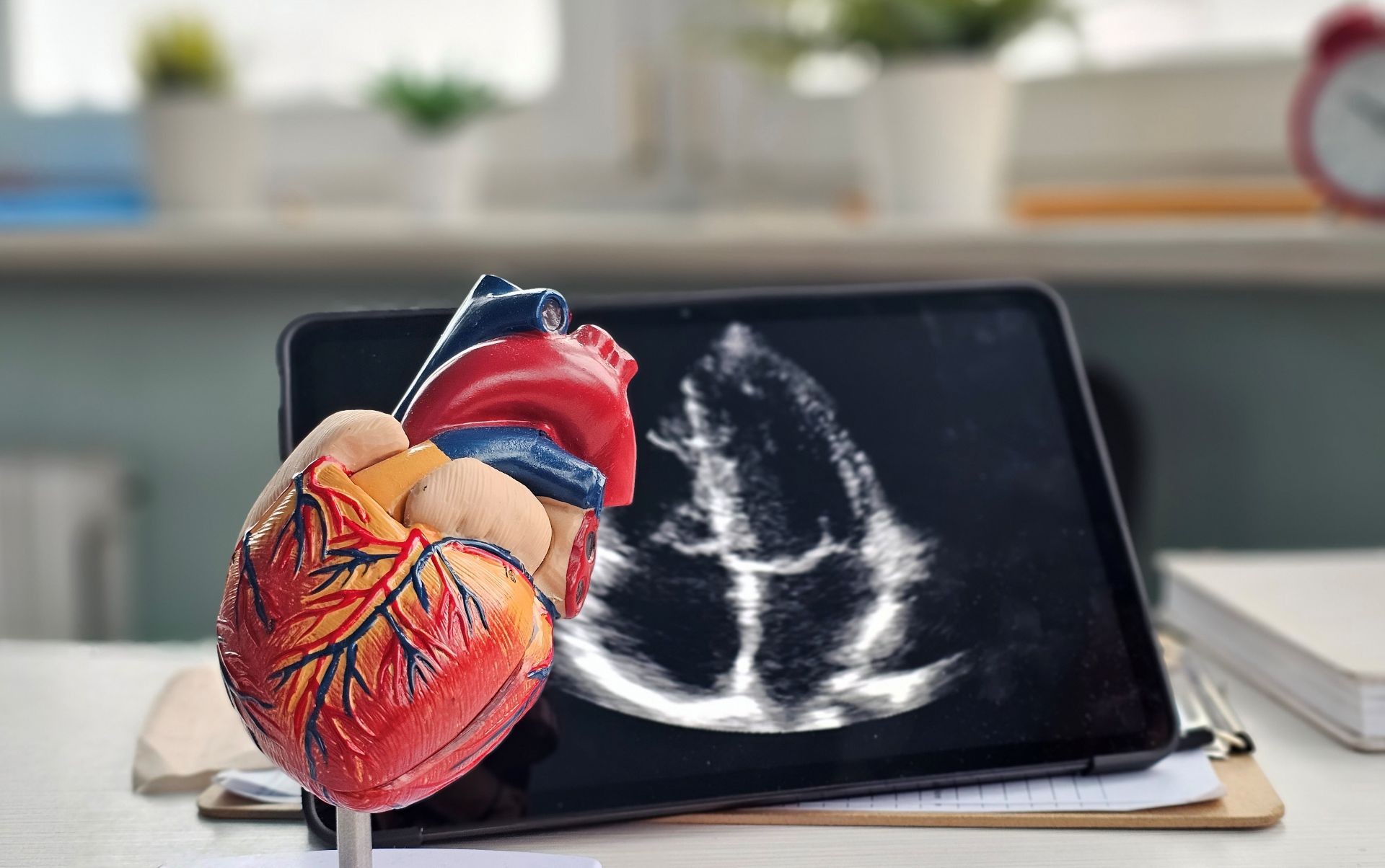 Image of an echocardiogram